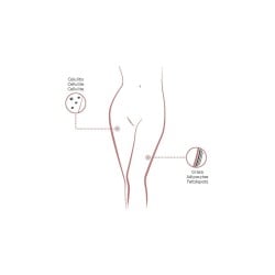 Anti-cellulite Pack - Active ingredients of mesotherapy  - BCN Packs - Institute BCN Packs