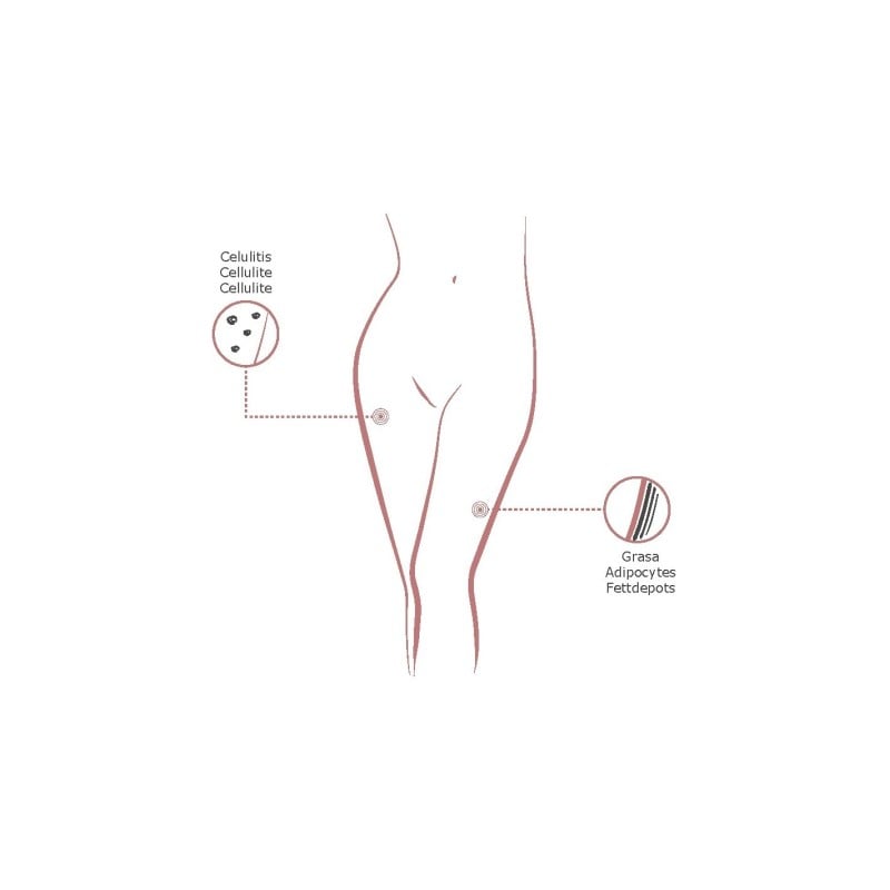 Institute BCN Packs - Pacote Anti-Celulite com Mesoterapia  - Pacotes BCN  - Institute BCN Packs